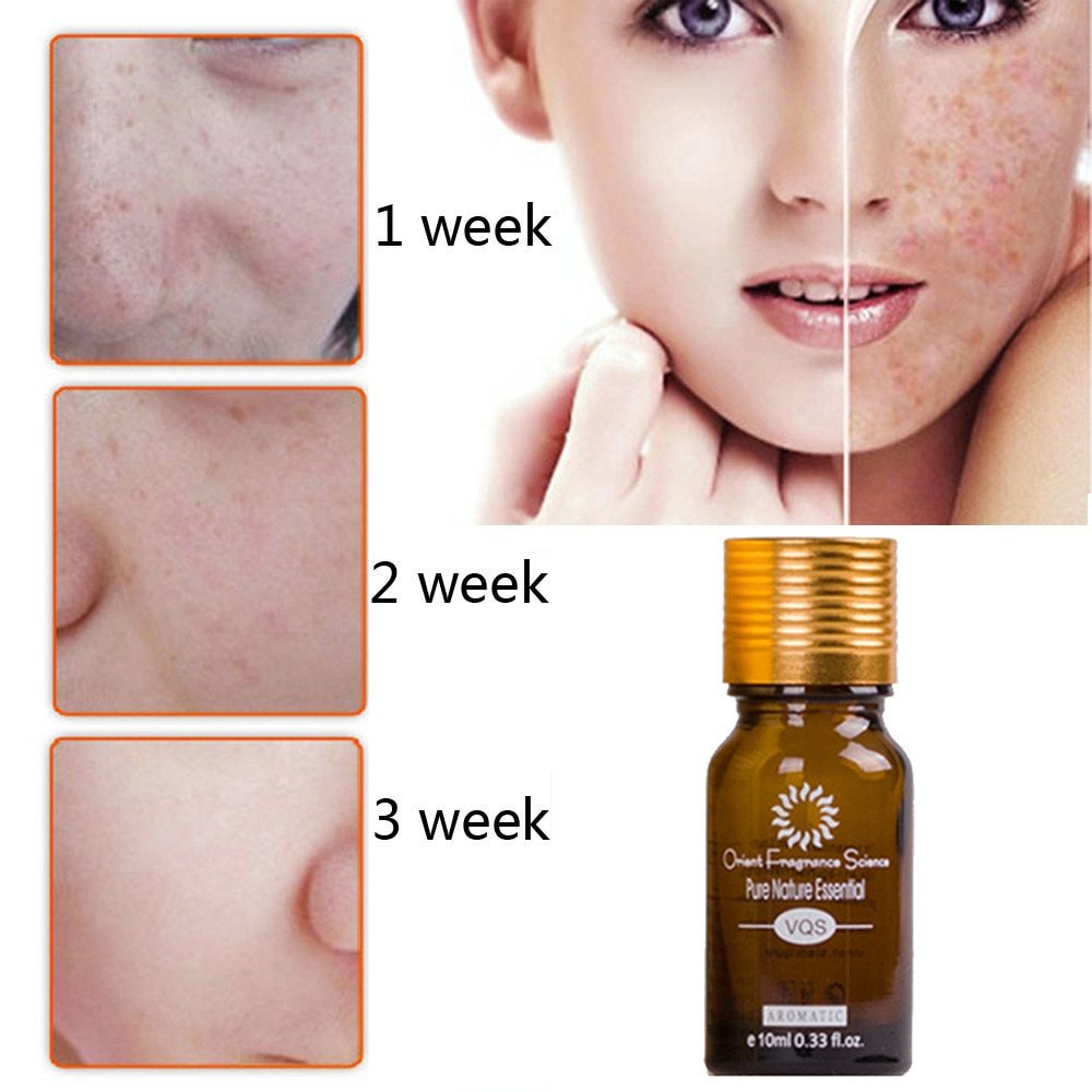Transform Your Skin with Dredge Meridian Skin Care - Acne Stretch Marks Scar Removal Oil
