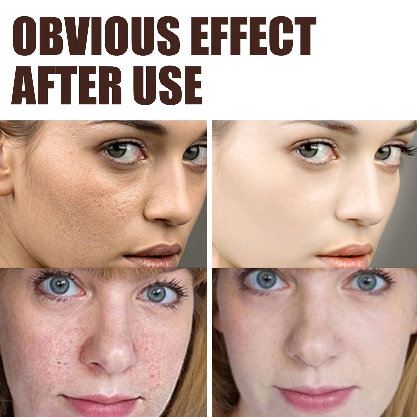 Retinol Anti Aging Cream for Wrinkle Removal and Skin Firming with Hyaluronic Acid